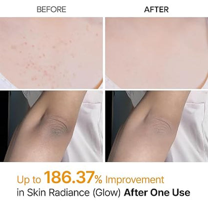 Dr.Melaxin Peel Shot Kojic Acid Turmeric Body Exfoliator Spray