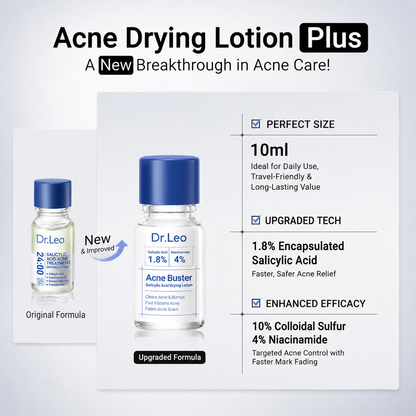 Acne Drying Lotion Plus (1.8% Encapsulated Salicylic Acid) — 10 mL
